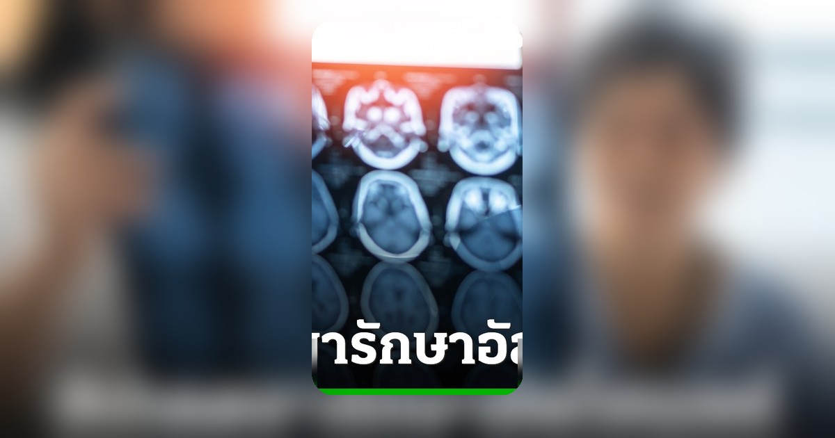 ความหวังใหม่! ยาต้านอัลไซเมอร์ ชะลอสมองเสื่อม ส่องนวัตกรรมทางการแพทย์