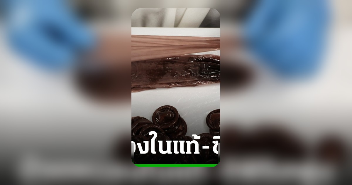 ยุโรปพบผู้ป่วยโรคหนองในแท้-ซิฟิลิส พุ่งสูงทุบสถิติรอบ 10 ปี สเปนพบมากที่สุด